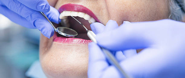 Best Emergency Dental Care for Sports Injuries in Lake Mack Forest Hills, FL